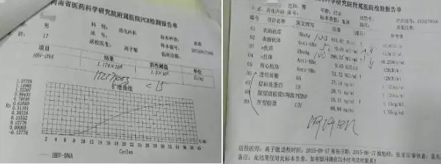 2015年8月秦先生的检查报告(病毒复制较快,已达1.174×108 copies/mL)
