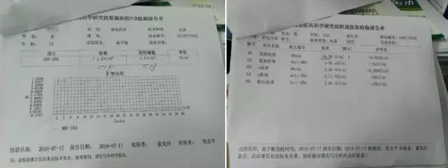 患者秦刚的检查报告(病毒已清除,数据都达到正常范围)